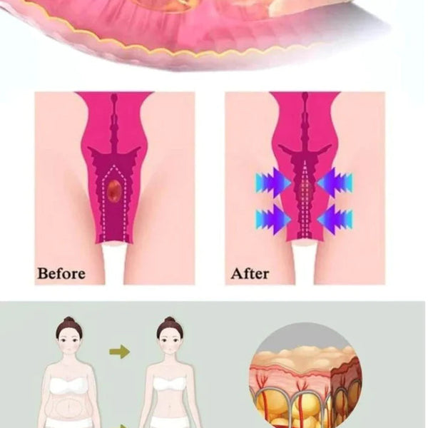 Gélules BioNaturelles de réparation vaginale (1 Achetez = 1 Offert)
