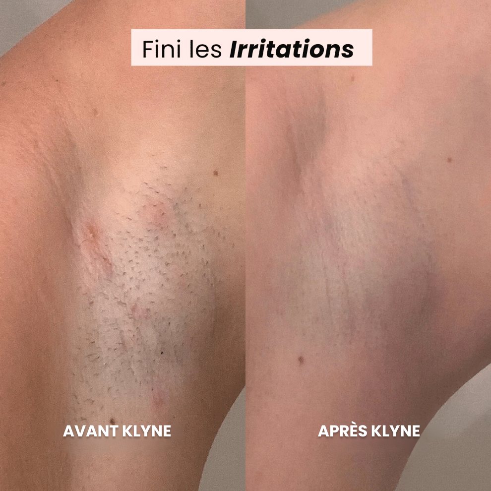 Le Rasoir de Luxe KLYNE®
