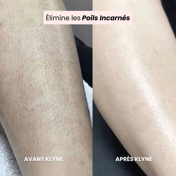 Le Rasoir de Luxe KLYNE®